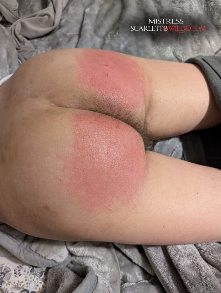 A Bare Red bottom of slave lies on the bed. Pants pulled down to the knees. Both cheeks are red hot.